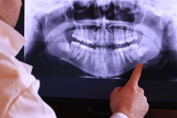 Best Pediatric Emergency Dentist in Felton, CA
