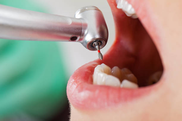 Best After-Hours Dental Trauma Care in Felton, CA